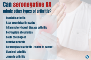 Seronegative Rheumatoid Arthritis mimics