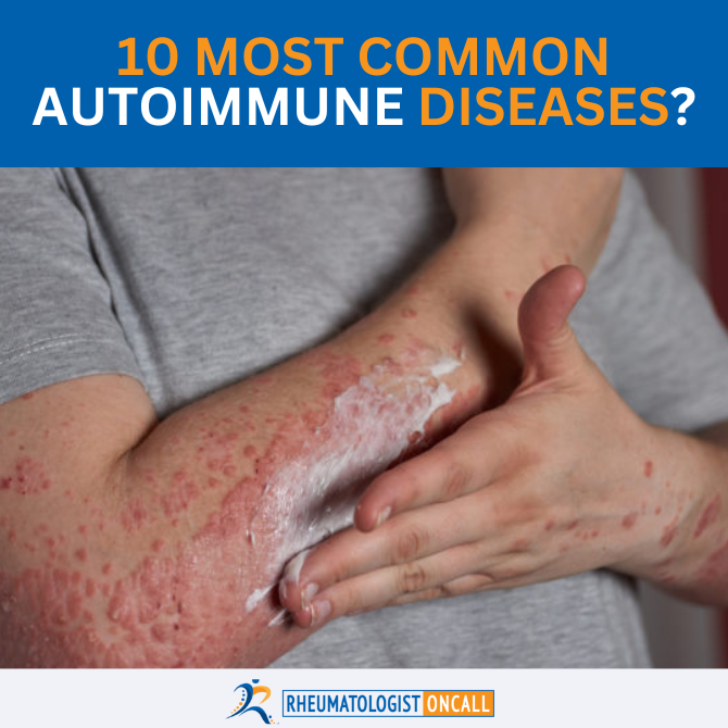 most common autoimmune diseases