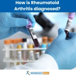 how rheumatoid arthritis is diagnosed